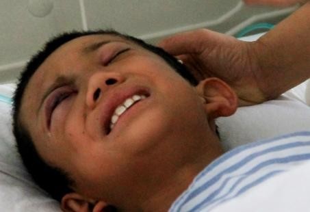 呼準公路發生校車被撞事故 7名學生受傷