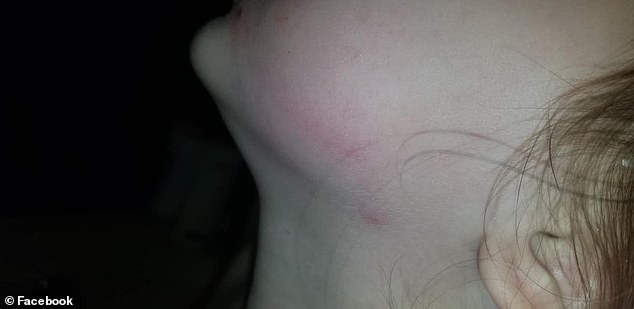 5歲的女孩臉上滿是瘀傷，原來在校車上被毆打了45分鐘