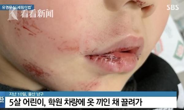 5歲女孩下校車時被門夾住 司機沒注意繼續拖行